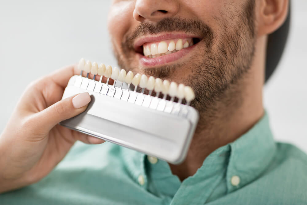 Man in green shirt having teeth shade matched for veneers