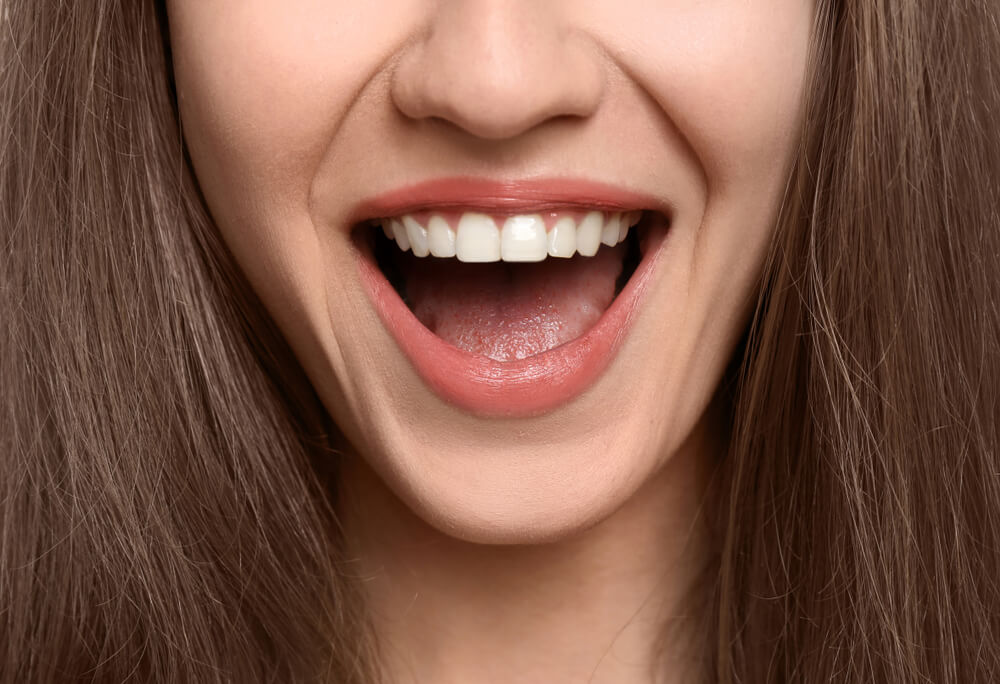 Close up of woman showing off smile with visible gumline
