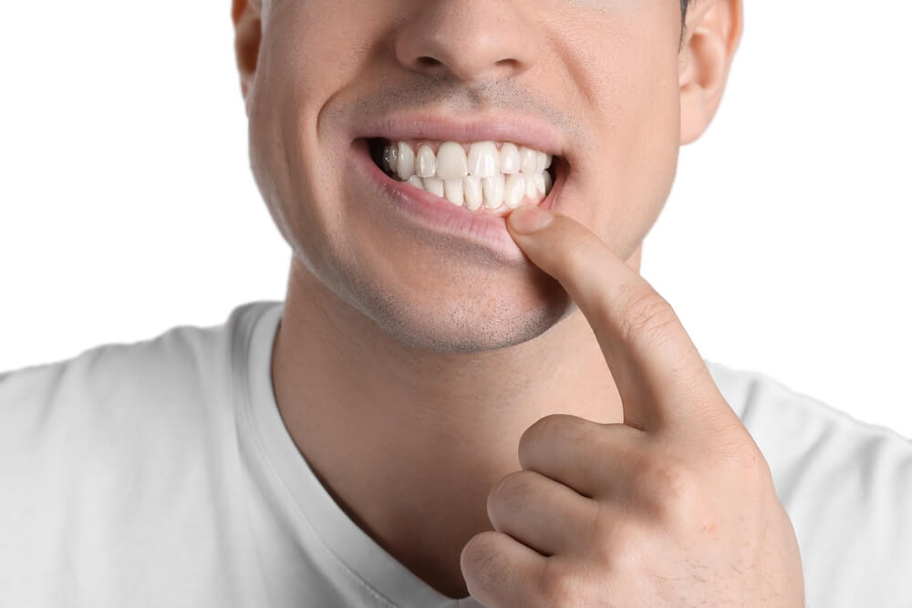 Man pulling his lip down showing his gum without gum recession anymore