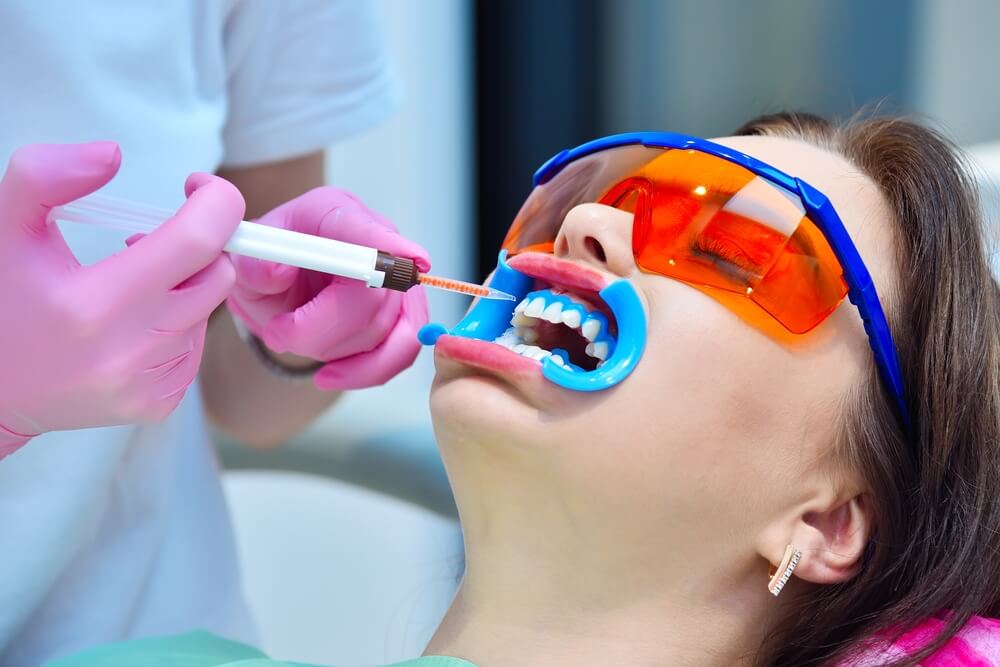 Person getting teeth whiten at professional teeth whitening dentist Austin