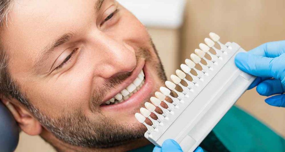 Man getting checked by the dentist testing different colors of porcelain veneers
