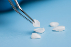 Picking up temporary veneers with metal forceps
